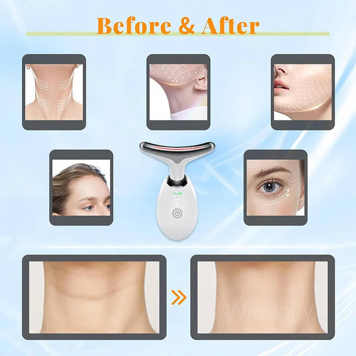 A-List Radiant Lift Spa Device™